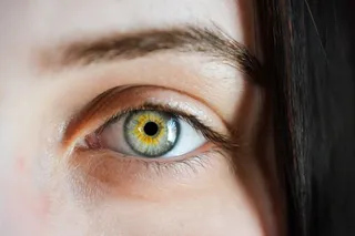Ojo