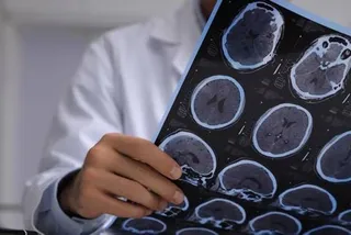 La Agencia Estatal de Investigación ha financiado 181 proyectos de investigación relacionados con el alzhéimer entre 2018 y 2022. AEI