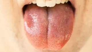 Los síntomas más desconocidos del coronavirus que pasan desapercibidos