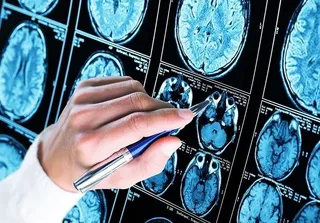 Europapress 2134818 investigadores de la us logran bloquear una proteina fundamental en el desarrollo del alzheimer