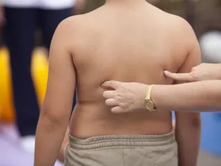 Preocupa la obesidad y el sobrepeso entre los jóvenes españoles