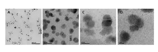 Avance en la lucha contra el cáncer con nanopartículas que atacan directamente las células tumorales