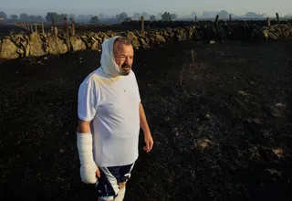 José Manuel Blanco, con quemaduras en varias partes del cuerpo, observa la zona arrasada el incendio forestal de Cipérez | José Vicente (Ical)