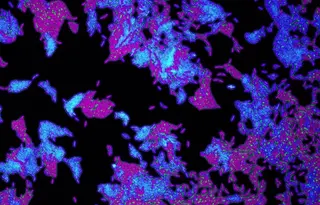 Células de la bacteria patógena 'Pseudomonas aeruginosa'. EP