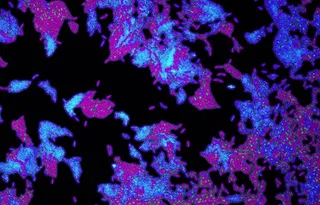 Células de la bacteria patógena 'Pseudomonas aeruginosa'. EP