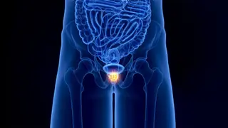 Cáncer de próstata | Comunicación Universidad de Salamanca