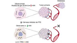 Investigadores del CIC (USAL-CSIC) descubren un mecanismo clave que impulsa la metástasis en el cáncer