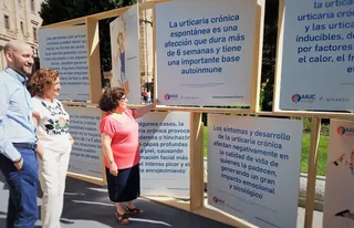 La urticaria, una enfermedad que va más allá de una simple alergia