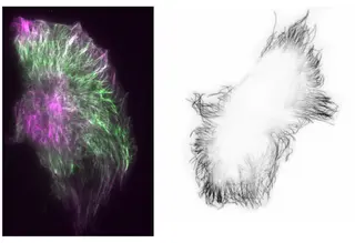 Imagen de microscopía que muestra la distribución de GEF-H1 y los microtúbulos en células tumorales.