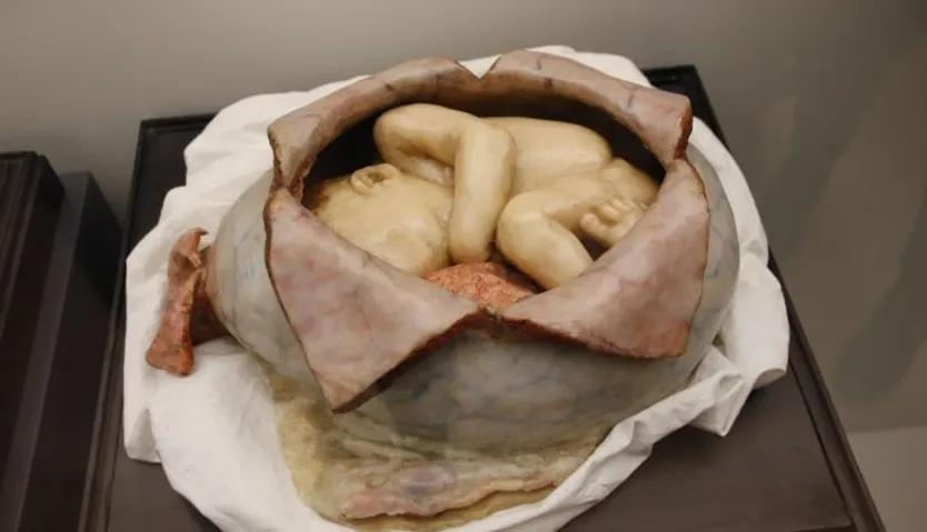 figuras anatómicas de cera coloreada de los siglos XIX y XX conservadas en el Departamento de Anatomía e Histologías Humanas de la Universidad de Salamanca