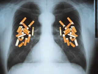 Pulmones fumador