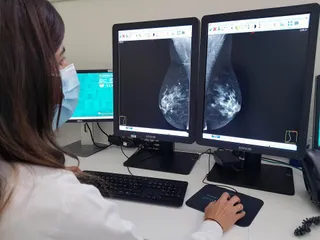 Mamografía en una foto de archivo