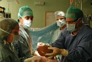 Donación de órganos. ARCHIVO