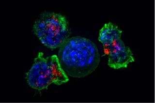 Un Caballo De Troya Contra El Cáncer: Células Diseñadas Genéticamente Y Ocultas En Biocápsulas Para Atacar Tumores Sólidos Desde Dentro - CSIC