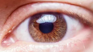 Glaucoma