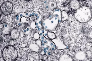 Partículas del virus SARS-CoV-2, coloreadas en azul, en una imagen de microscopio de electrones. / - CDC