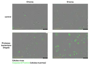 Colaboración internacional liderada por el Centro de Investigación del Cáncer revela un mecanismo bacteriano capaz de destruir células tumorales | Centro de Investigación del Cáncer / (CIC-IBMCC)