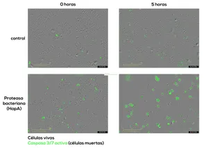 Colaboración internacional liderada por el Centro de Investigación del Cáncer revela un mecanismo bacteriano capaz de destruir células tumorales | Centro de Investigación del Cáncer / (CIC-IBMCC)