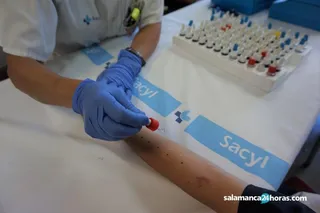 Prueba de la alergia (2)