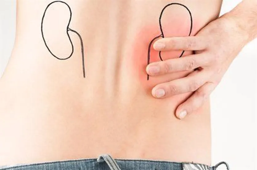 Enfermedad renal. Foto Infosalus