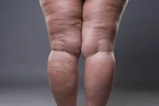 Infosalus