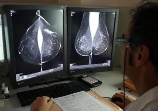 Estudio de una mamografía digital en el servicio de mamografías del Hospital Río Hortega de Valladolid. Foto: Rubén Cacho (ICAL)