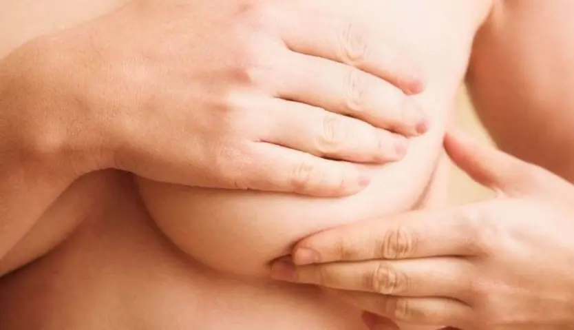 Cáncer de mama