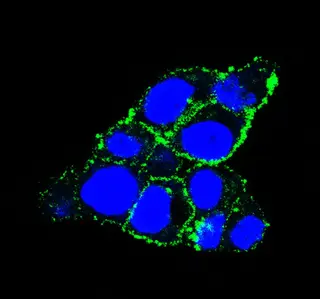 El Centro de Investigación del Cáncer (USAL-CSIC) lidera un estudio acerca de una nueva terapia dirigida contra el cáncer de páncreas | CIC