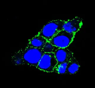 El Centro de Investigación del Cáncer (USAL-CSIC) lidera un estudio acerca de una nueva terapia dirigida contra el cáncer de páncreas | CIC