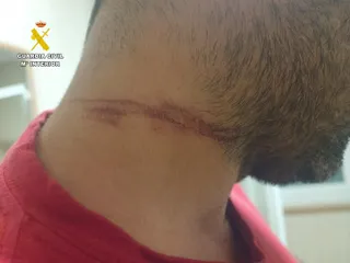Hombre herido por una trampa en el campo de Salamanca | Guardia Civil de Salamanca