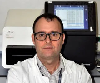 Identifican un nuevo gen causante de la anemia de Fanconi
