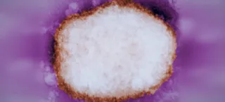 Partícula amplificada del virus de la viruela del mono. Foto EP