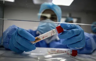 Coronavirus recursos sanitarios (3)