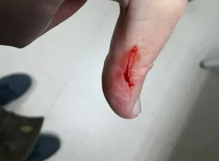 Topas herido 2