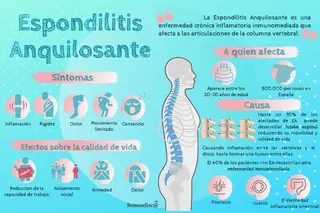 Espondilitis