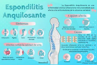 Espondilitis