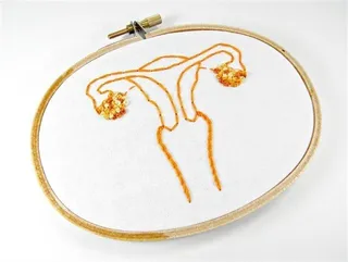 CÁNCER CUELLO DE ÚTERO