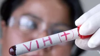 VIH. Foto EP