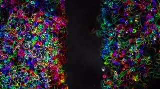 Células de cáncer de páncreas | EUROPA PRESS