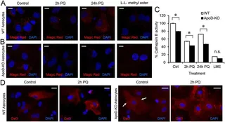 Desvelan el mecanismo de acción de una proteína clave en el envejecimiento y las enfermedades neurodegenerativas
