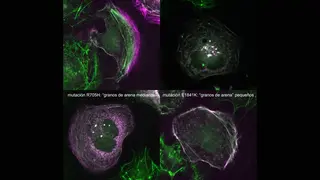 El CIC descubre cómo las mutaciones en el gen MYH9 dictan la gravedad de enfermedades raras de la sangre | Centro de Investigación del Cáncer / (CIC-IBMCC)
