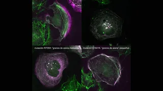 El CIC descubre cómo las mutaciones en el gen MYH9 dictan la gravedad de enfermedades raras de la sangre | Centro de Investigación del Cáncer / (CIC-IBMCC)