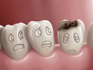 El frío provoca dolor en los dientes, ¿a qué se debe esta sensación?