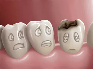 El frío provoca dolor en los dientes, ¿a qué se debe esta sensación?