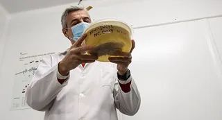 El biobanco de la USAL referencia de Castilla y León en la donación de tejido cerebral.