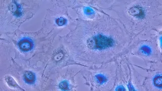 Senescencia celular | USAL