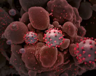 Representación creativa de las partículas del virus del SARS-CoV-2, causante de la COVID-19. EP
