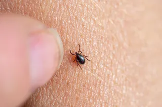 Imagen de una garrapata marrón en la piel humana con un dedo femenino a punto de retirarla. - FUNDACIÓN SOS LYME - Archivo