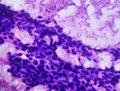 De utilizarse durante el posparto a poder ser útil para reducir el riesgo de cáncer de mama - USAL