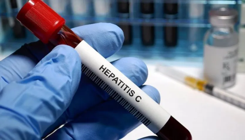 Prueba de Hepatitis C - HAILSHADOW - Archivo